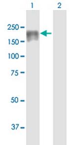 DIP2C Antibody in Western Blot (WB)