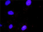 DAAM1 Antibody in Proximity Ligation Assay (PLA) (PLA)