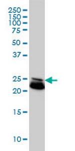 RAB21 Monoclonal Antibody (1F6)