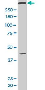 SMG1 Antibody in Western Blot (WB)