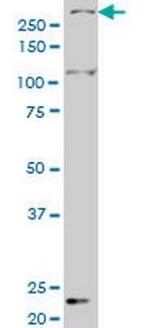 SMG1 Antibody in Western Blot (WB)