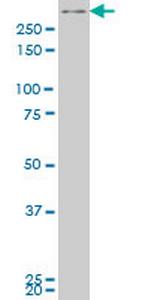 SMG1 Antibody in Western Blot (WB)