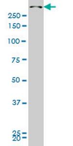 SMG1 Monoclonal Antibody (4E4)