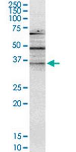 NMNAT2 Monoclonal Antibody (4E6)