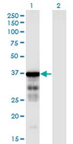 CLUAP1 Monoclonal Antibody (6E12)