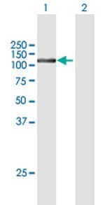 FTSJD2 Polyclonal Antibody, MaxPab™