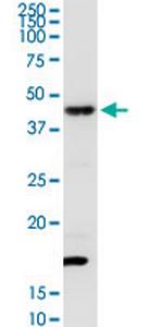 TXNDC4 Polyclonal Antibody, MaxPab™
