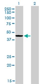 TXNDC4 Antibody in Western Blot (WB)