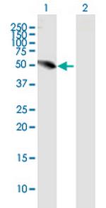 UHRF1BP1L Polyclonal Antibody, MaxPab™