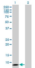 ERC1 Antibody in Western Blot (WB)