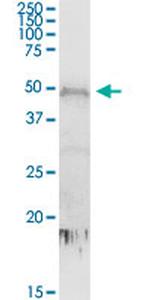 CDC2L6 Antibody in Western Blot (WB)
