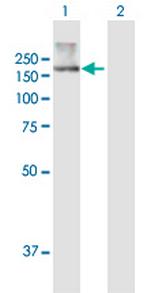 ATP10B Polyclonal Antibody, MaxPab™