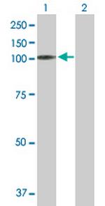 MAST2 Polyclonal Antibody, MaxPab™