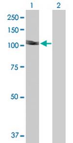 DIP2A Polyclonal Antibody, MaxPab™