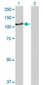 DIP2A Polyclonal Antibody, MaxPab™