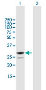 MESDC2 Polyclonal Antibody, MaxPab™