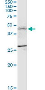 FBXL7 Monoclonal Antibody (2G10)