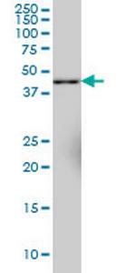 SYT11 Monoclonal Antibody (4E1)