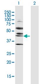 RRS1 Polyclonal Antibody, MaxPab™