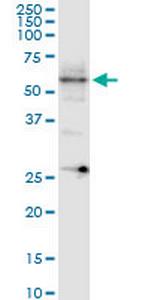 ARHGEF9 Monoclonal Antibody (3C11)