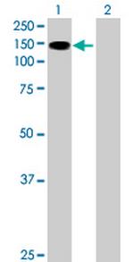 SIK2 Polyclonal Antibody, MaxPab™