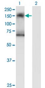 SIK2 Monoclonal Antibody (4H6)