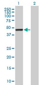 ASTN2 Polyclonal Antibody, MaxPab™