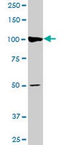 AGTPBP1 Monoclonal Antibody (2B9)