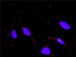FBXW11 Antibody in Proximity Ligation Assay (PLA) (PLA)