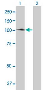 ATMIN Polyclonal Antibody, MaxPab™