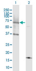 ACSL6 Polyclonal Antibody, MaxPab™