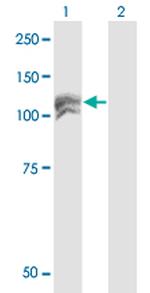 NEDD4L Monoclonal Antibody (1D2)