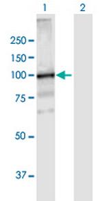 VPS39 Polyclonal Antibody, MaxPab™