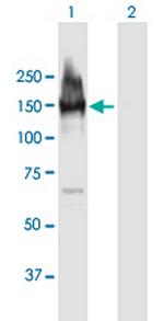 LARP1 Polyclonal Antibody, MaxPab™