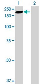 EST1B Antibody in Western Blot (WB)
