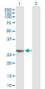 NUDCD3 Polyclonal Antibody, MaxPab™