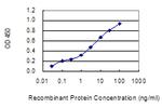 MED13L Monoclonal Antibody (4H2)