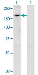 ADNP Antibody in Western Blot (WB)
