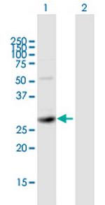 SIRT5 Polyclonal Antibody, MaxPab™