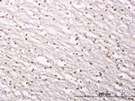 SIRT1 Antibody in Immunohistochemistry (Paraffin) (IHC (P))