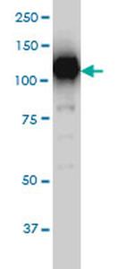 SIRT1 Antibody in Western Blot (WB)
