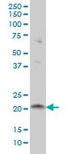 ITGB3BP Monoclonal Antibody (3F6)