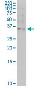 OTP Monoclonal Antibody (8E12)