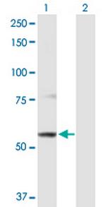 ABCB9 Polyclonal Antibody, MaxPab™