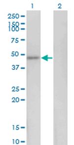 HEY1 Monoclonal Antibody (1E10)