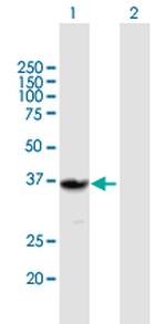 QPRT Polyclonal Antibody, MaxPab™