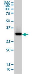 QPRT Monoclonal Antibody (5D11)