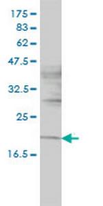 NIFUN Monoclonal Antibody (3B8-1C4)