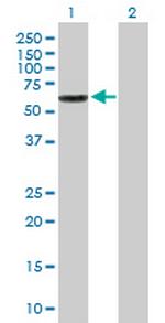 CES3 Polyclonal Antibody, MaxPab™