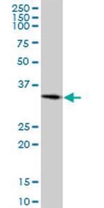 CBX7 Antibody in Western Blot (WB)